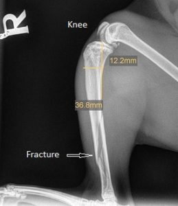 X-ray showing the fracture 2